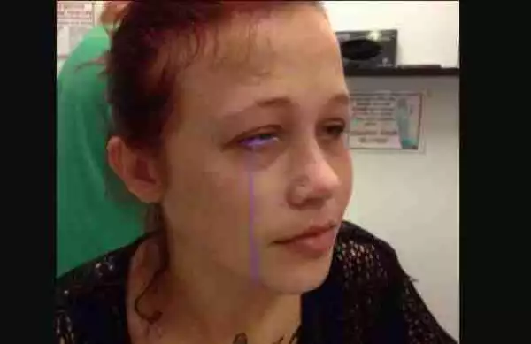 Horror: Beautiful Model Left Crying Purple Tears After Getting A Tattoo On Her Eyeball (Graphic Photos)